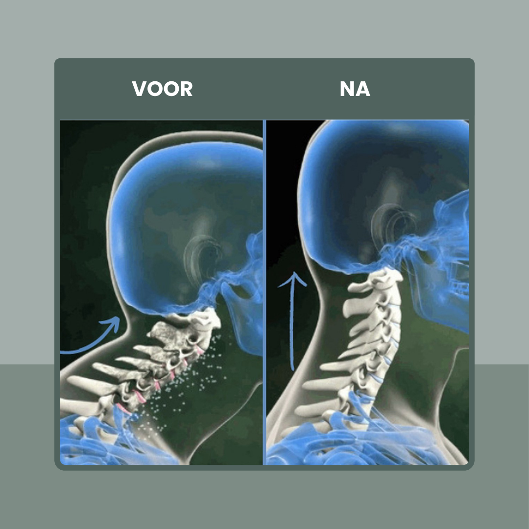 NeckReset™️ - herstel je houding, ontspan je hoofd.
