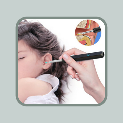 ClearScope™️ Oorscan - Slimme oorreiniger met livebeeld