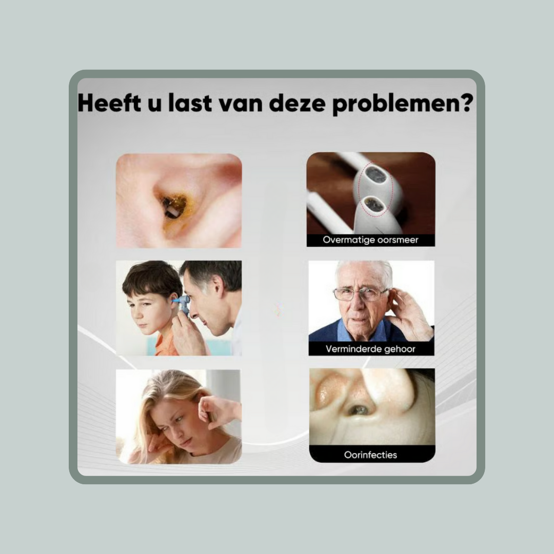 ClearScope™️ Oorscan - Slimme oorreiniger met livebeeld